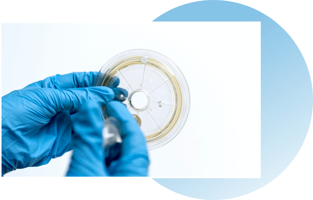 Consumabile OvaCyte